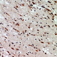CD58 Rabbit Polyclonal Antibody