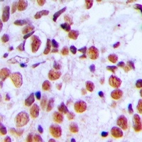 Histone H2A.X (Phospho-S139) Rabbit Polyclonal Antibody