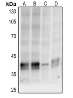 p38 (Phospho-T180/Y182) Rabbit Polyclonal Antibody