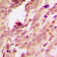 p38 (Phospho-T180/Y182) Rabbit Polyclonal Antibody