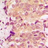 p38 Rabbit Polyclonal Antibody