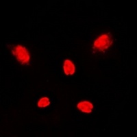 p38 Rabbit Polyclonal Antibody