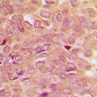 STAT5 Rabbit Polyclonal Antibody