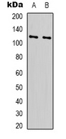 RPS6KC1 Rabbit Polyclonal Antibody