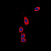 RPS6KC1 Rabbit Polyclonal Antibody