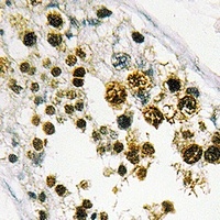 MRG15 Rabbit Polyclonal Antibody