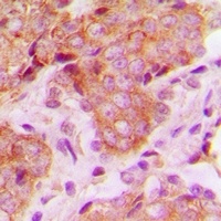 MRPS22 Rabbit Polyclonal Antibody