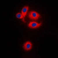 MRPS22 Rabbit Polyclonal Antibody