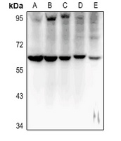 MT-ND5 Rabbit Polyclonal Antibody