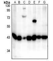 p38 Rabbit Polyclonal Antibody