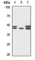 RRS1 Rabbit Polyclonal Antibody