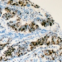 RRS1 Rabbit Polyclonal Antibody