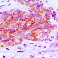 EGFR (Phospho-Y1016) Rabbit Polyclonal Antibody