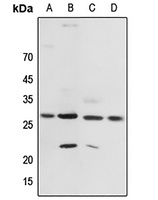14-3-3 zeta (Phospho-T232) Rabbit Polyclonal Antibody