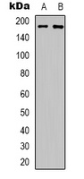 HER3 (Phospho-Y1289) Rabbit Polyclonal Antibody