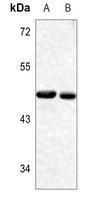 YBX1 (Phospho-S102) Rabbit Polyclonal Antibody