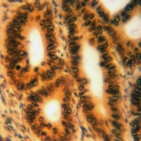 YBX1 (Phospho-S102) Rabbit Polyclonal Antibody