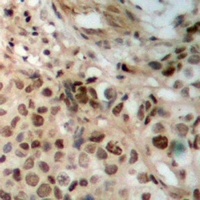 JAK2 Rabbit Polyclonal Antibody
