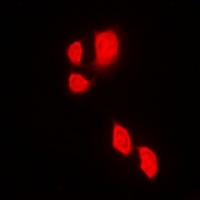 JAK2 Rabbit Polyclonal Antibody