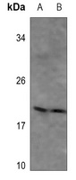 MYL9 Rabbit Polyclonal Antibody