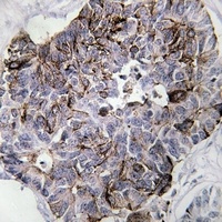 MYL9 Rabbit Polyclonal Antibody