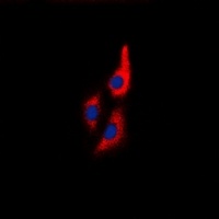 MYL9 Rabbit Polyclonal Antibody