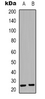 Syndecan 4 Rabbit Polyclonal Antibody