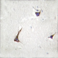 Syndecan 4 Rabbit Polyclonal Antibody