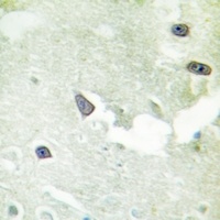GKAP Rabbit Polyclonal Antibody
