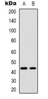 TBX1 Rabbit Polyclonal Antibody
