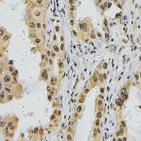 TBX1 Rabbit Polyclonal Antibody