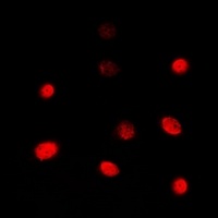 TBX1 Rabbit Polyclonal Antibody