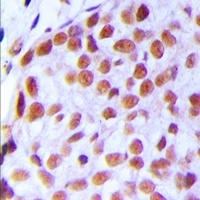TAF5L Rabbit Polyclonal Antibody