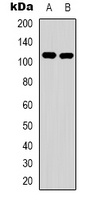 EPHA1 Rabbit Polyclonal Antibody