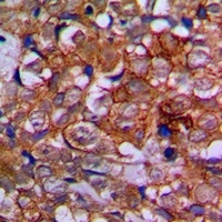 EPHA1 Rabbit Polyclonal Antibody