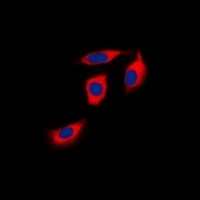EPHA1 Rabbit Polyclonal Antibody