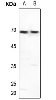 GTF2H1 Rabbit Polyclonal Antibody