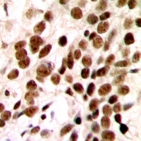 GTF2H1 Rabbit Polyclonal Antibody