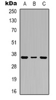 PIG3 Rabbit Polyclonal Antibody