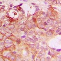 PIG3 Rabbit Polyclonal Antibody
