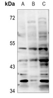 BTBD6 Rabbit Polyclonal Antibody