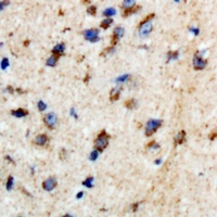 BTBD6 Rabbit Polyclonal Antibody