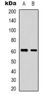 YTHDF1 Rabbit Polyclonal Antibody