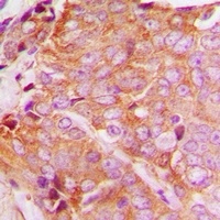 YTHDF1 Rabbit Polyclonal Antibody