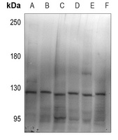 ZC3H7B Rabbit Polyclonal Antibody