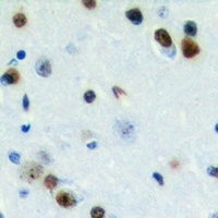 ZC3H7B Rabbit Polyclonal Antibody