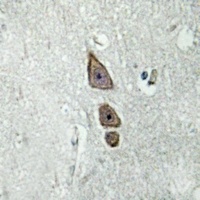 ARMCX3 Rabbit Polyclonal Antibody