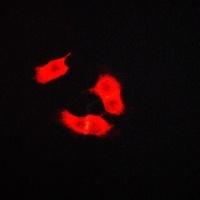 ARMCX3 Rabbit Polyclonal Antibody
