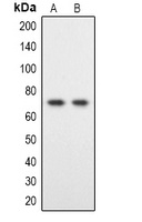 DYRK1B Rabbit Polyclonal Antibody