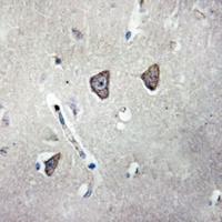 5-HT2C Rabbit Polyclonal Antibody